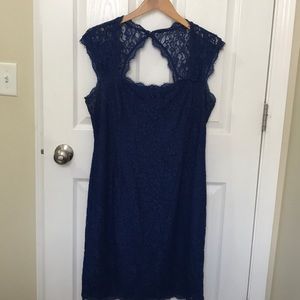 Lace dress